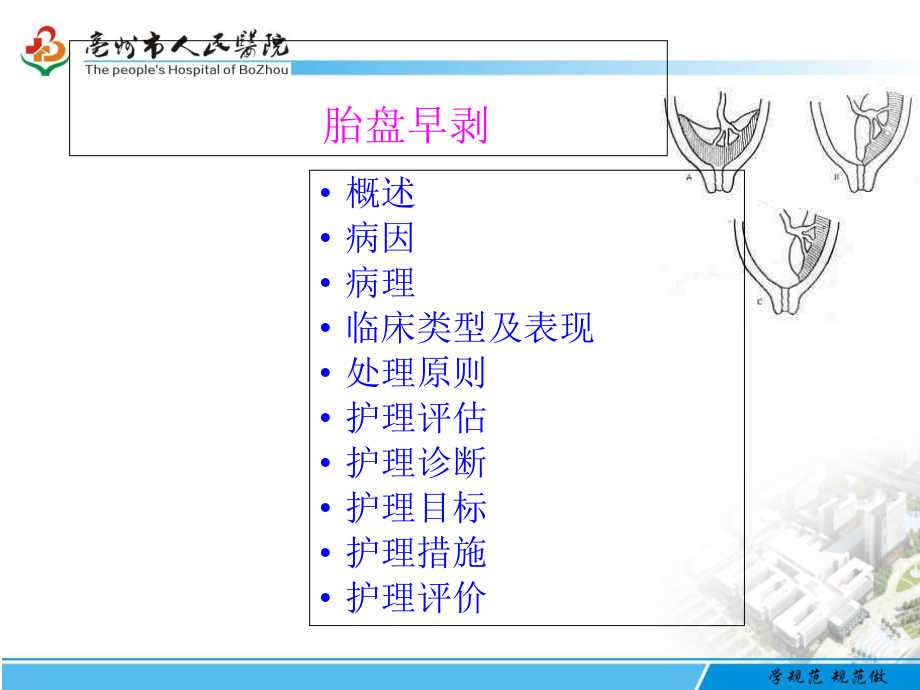 胎盘早剥护理ppt课件.ppt_第2页