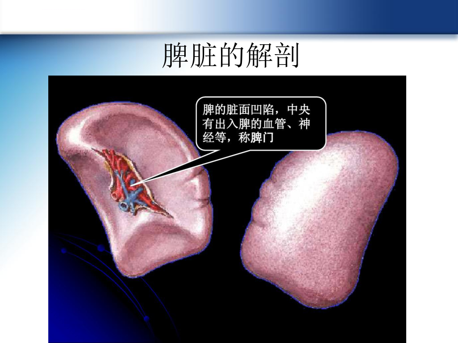 脾破裂的超声诊断ppt课件.ppt_第2页