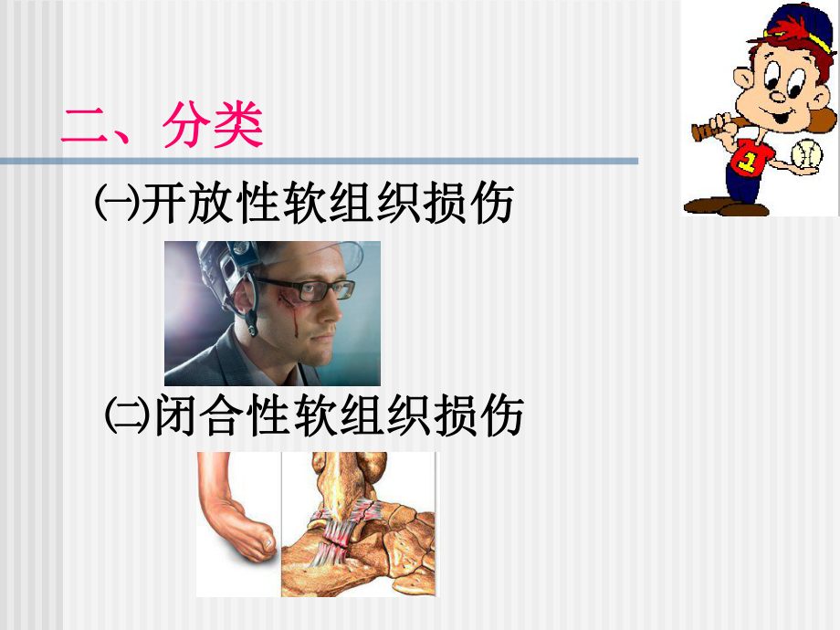 常见运动伤病的处理及治疗.ppt_第2页