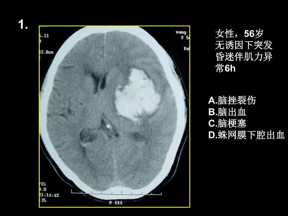 影像医学读片考试ppt课件.ppt_第2页