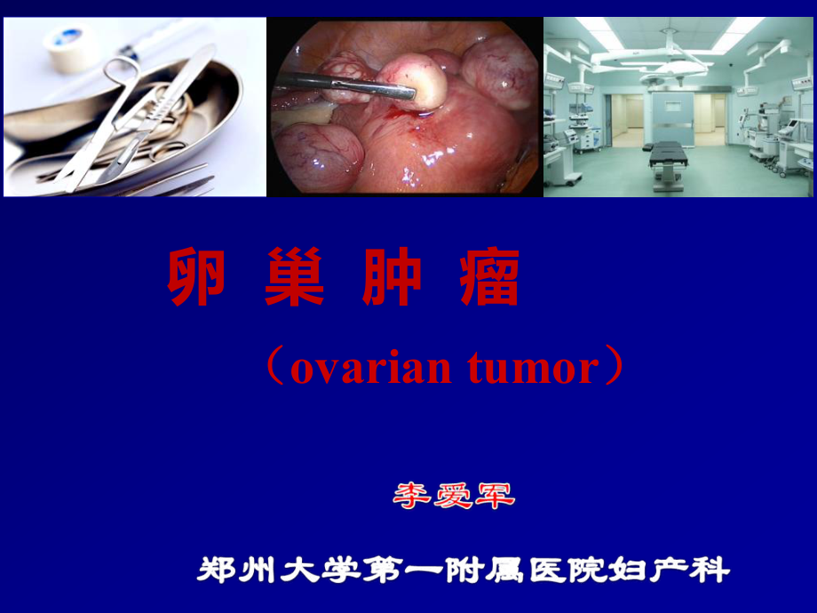 妇产科笔记妇产科重点卵巢肿瘤ppt课件.ppt_第1页