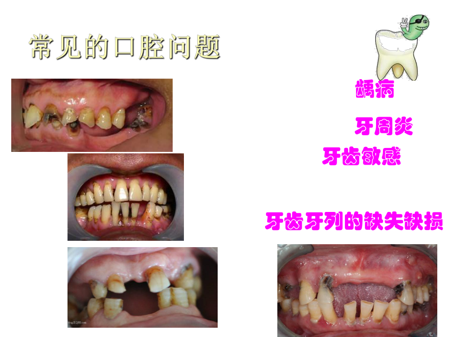 口腔保健与疾病预防.ppt_第2页