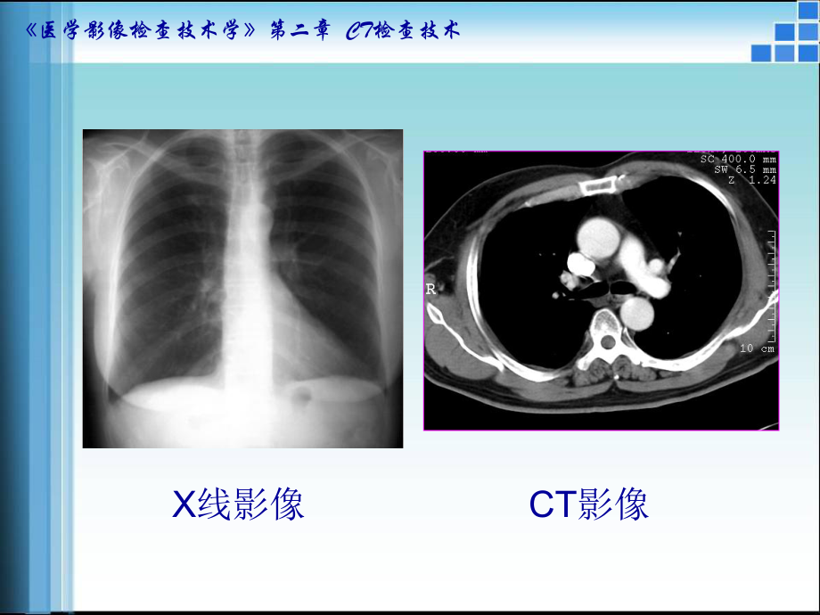 CT检查技术.ppt_第2页