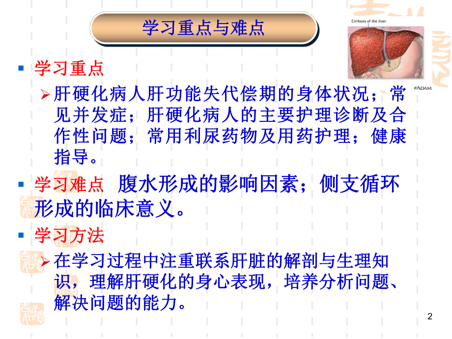 第四节肝硬化病人的护理ppt课件.ppt_第2页