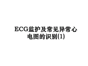 ECG监护及常见异常心电图的识别(1).ppt