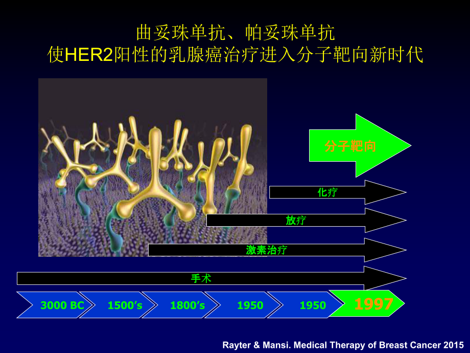 HER2阳性复发转移乳腺癌诊疗策略.ppt_第2页