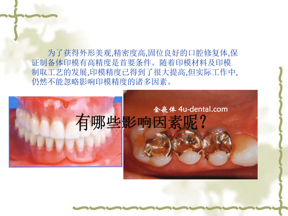 最新印模精度的影响因素ppt课件.ppt_第2页