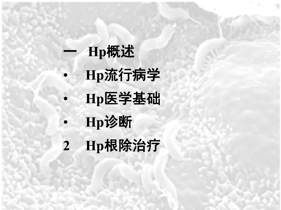 Hp的最新诊治讲解.ppt_第2页