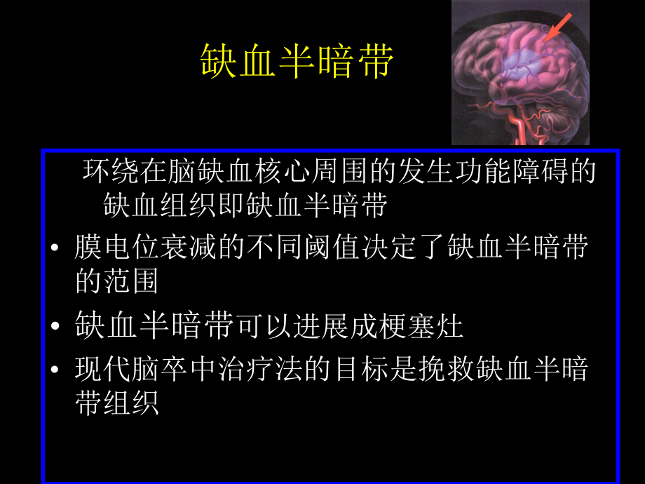 最新卒中的进展PPT课件.ppt_第2页