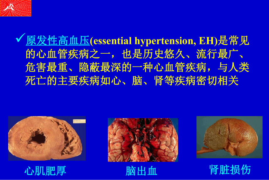 最新原发性高血压研究的新进展线粒体基因突变在原发性高血压ppt课件.ppt_第2页