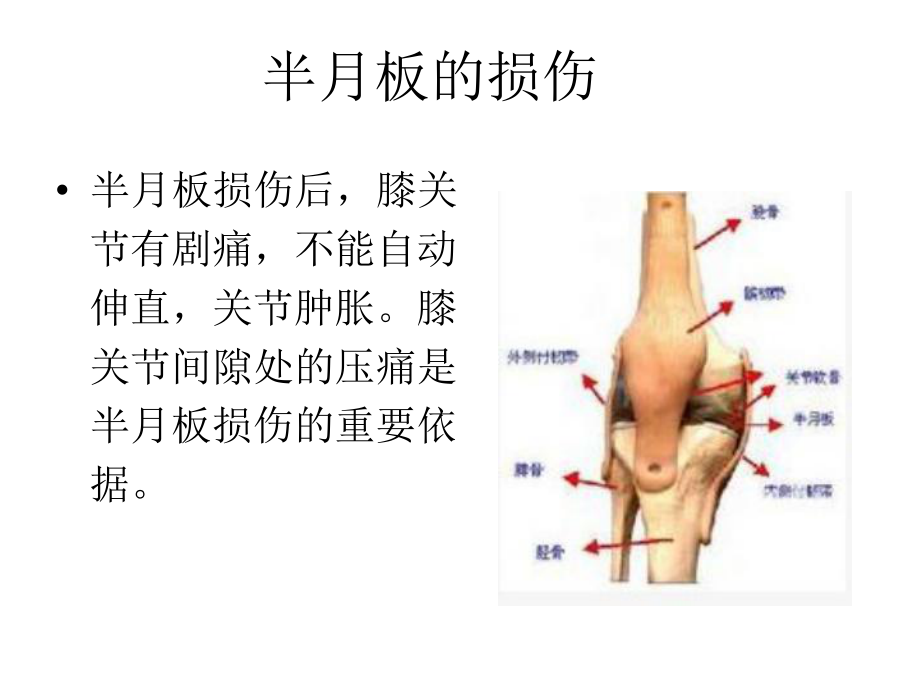 最新半月板的损伤精品课件.ppt_第2页