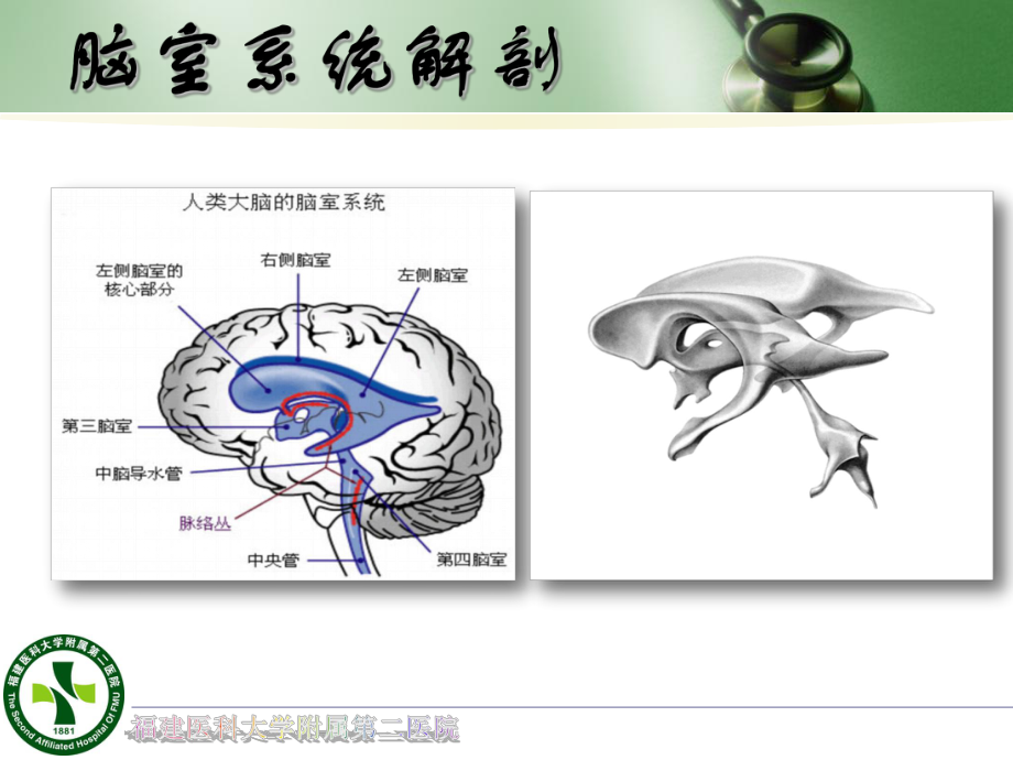 侧脑室外引流ppt课件.ppt_第2页