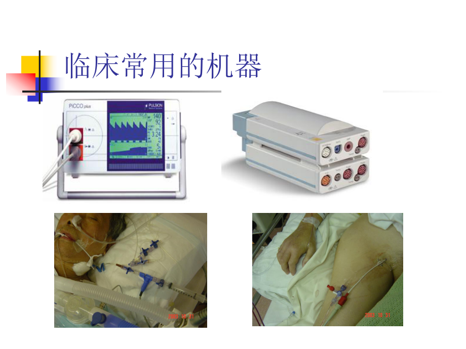 PICCO技术在ICU的应用和护理1.ppt_第2页