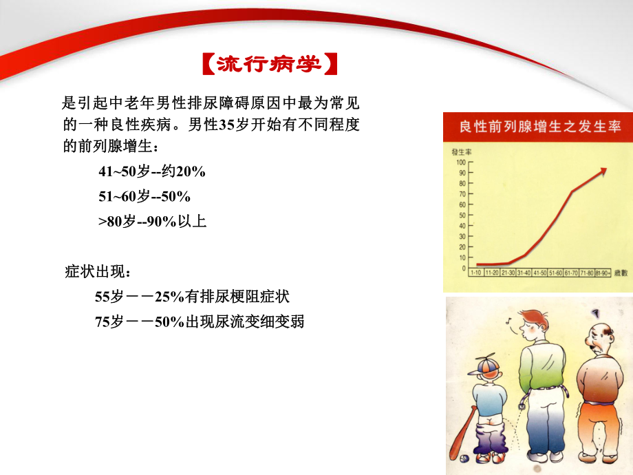 前列腺增生症ppt课件.ppt_第2页