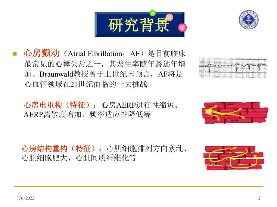 最新吡格列酮对糖尿病兔心房重构的影响和机制研究ppt课件.ppt_第2页