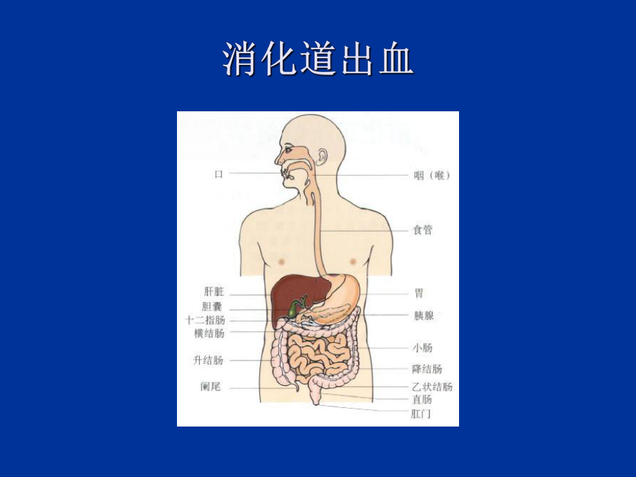 最新呕血与便血2ppt课件.ppt_第2页