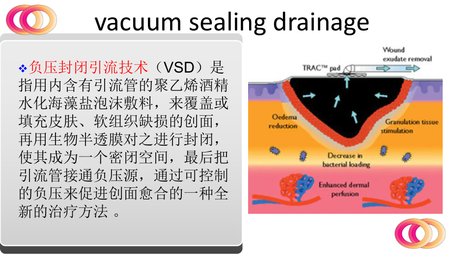 VSD护理查房.ppt_第2页