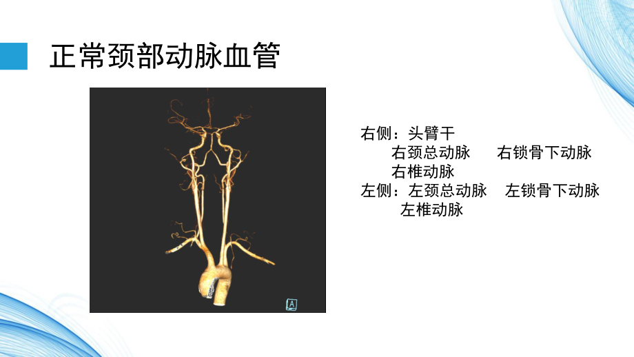 头颈部血管变异ppt课件.pptx_第2页