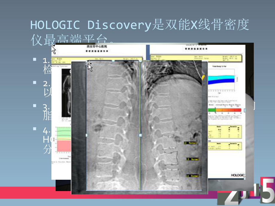 双能x线骨密度仪应用hologicppt课件.ppt_第2页