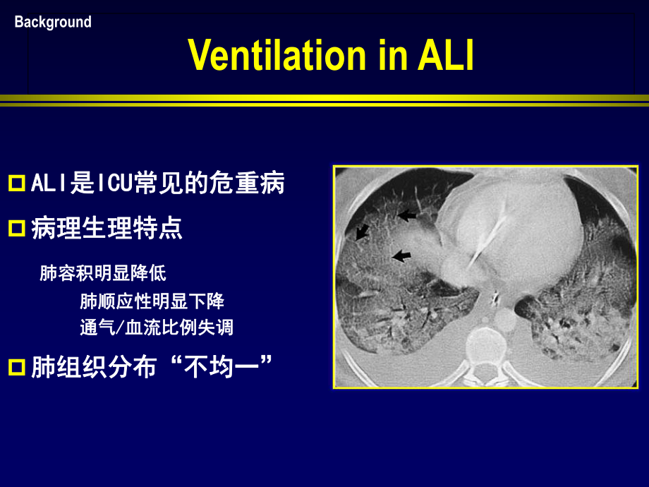 stressindex病理生理基础.ppt_第2页