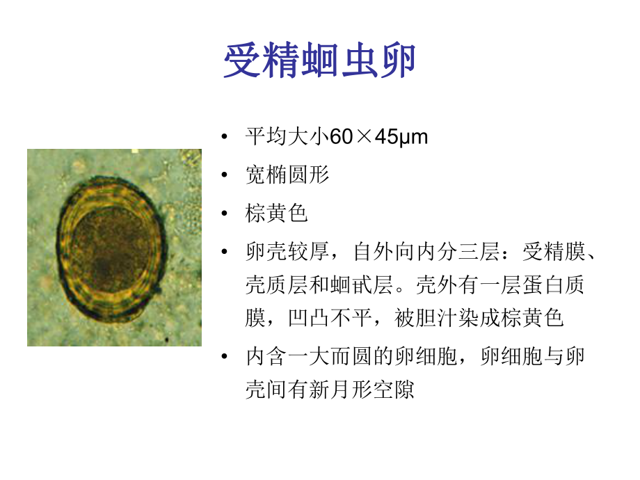 最新土线生活史、病原、诊断和操作知识精品课件.ppt_第2页