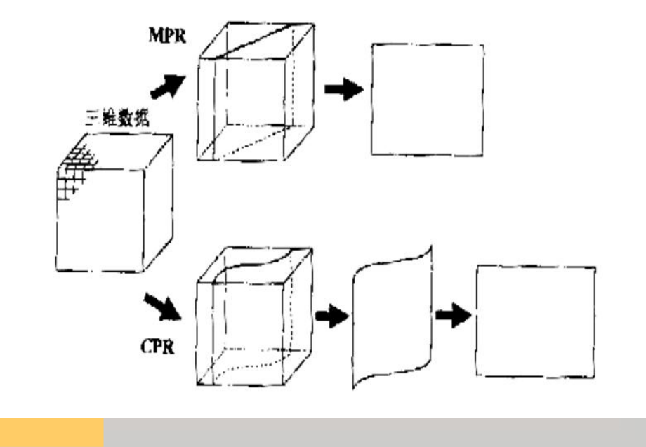 最新多平面重建MPRPPT课件.ppt_第2页