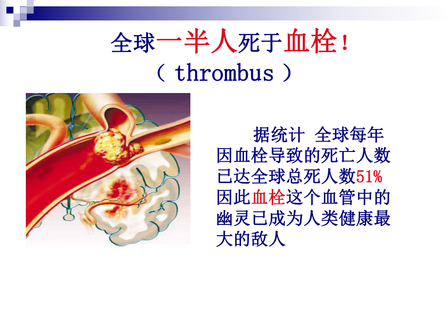 血栓性疾病ppt课件.ppt_第2页