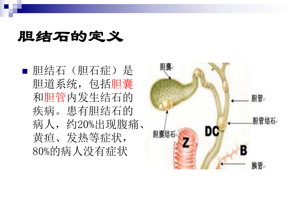 最新外科学2-温医大-胆石症的治疗现状与新进展-新幻灯片.ppt_第2页