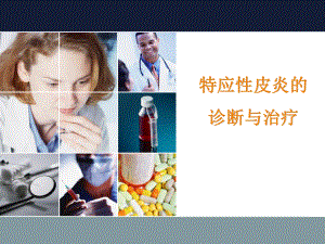 特应性皮炎的诊断与治疗ppt课件.ppt