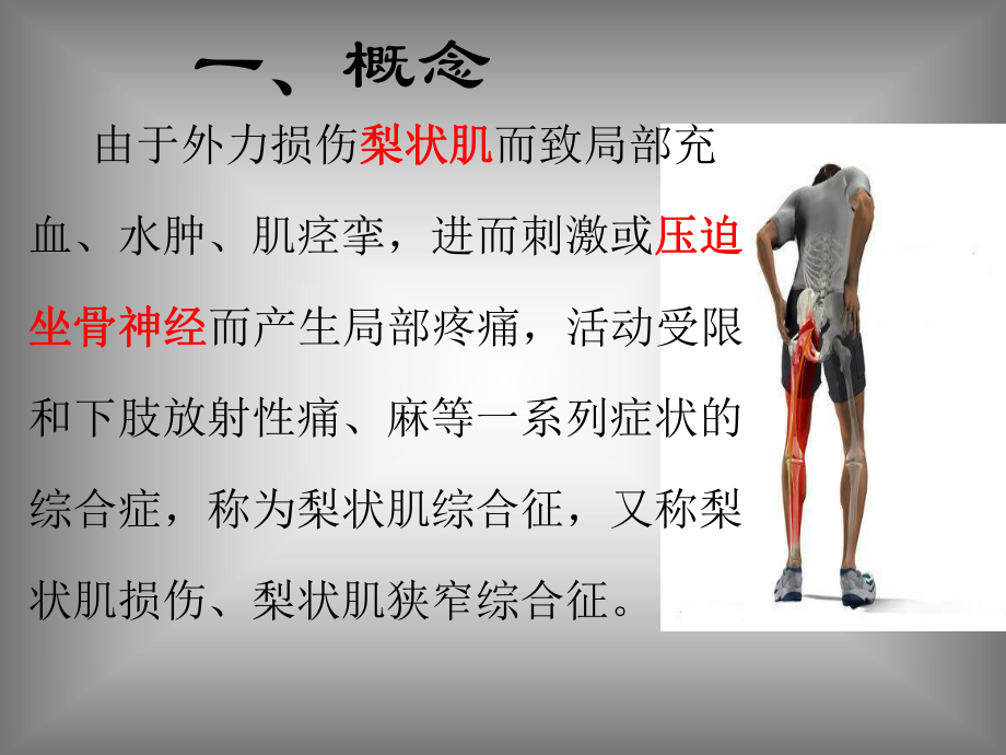 梨状肌综合征课件ppt.ppt_第2页