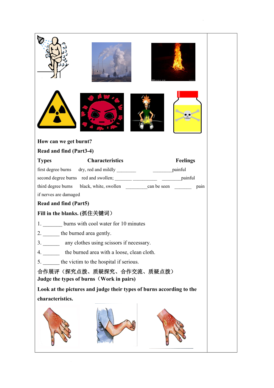 Unit 5 First Aid Reading and thinking学案--高中英语人教版（2019）选择性必修第二册.docx_第2页