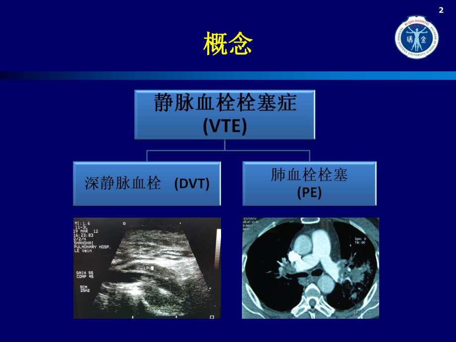 低分子肝素的分类ppt课件.ppt_第2页