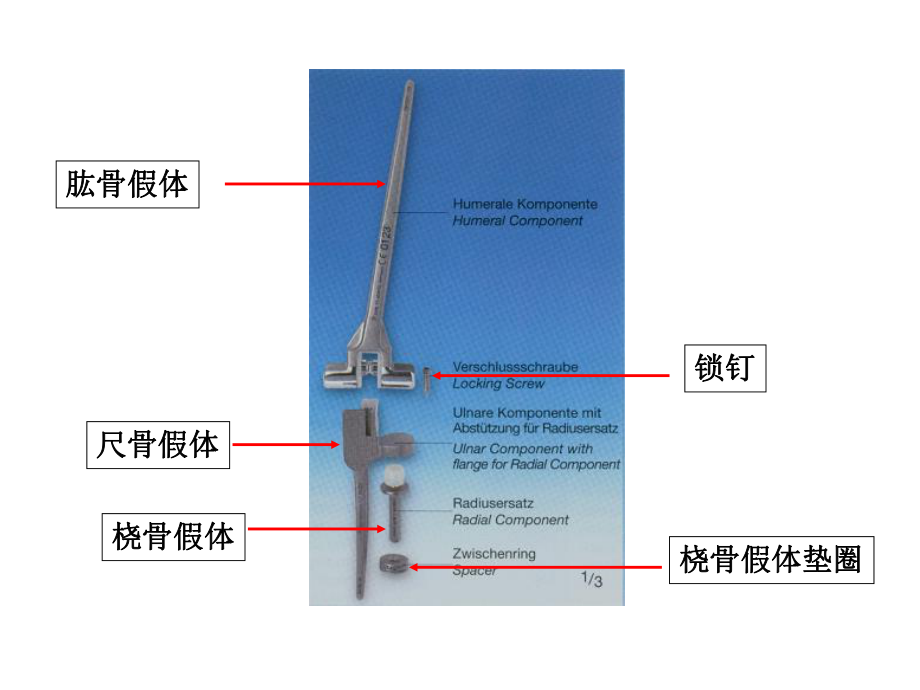 肘关节置换ppt课件.ppt_第2页