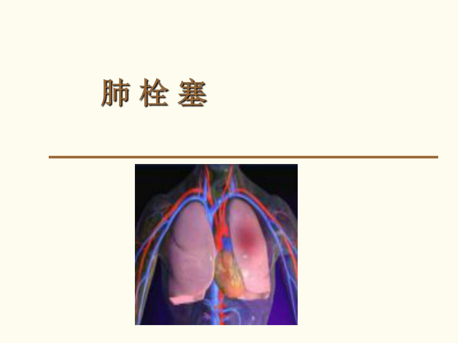 肺栓塞影像表现ppt课件.pptx_第1页