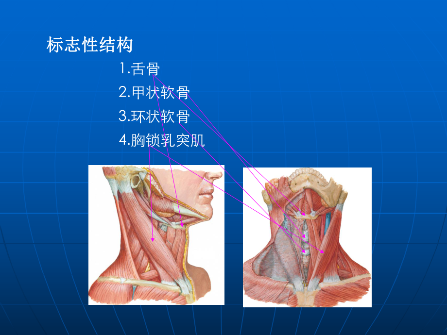 颈部淋巴结分区ppt课件.ppt_第2页