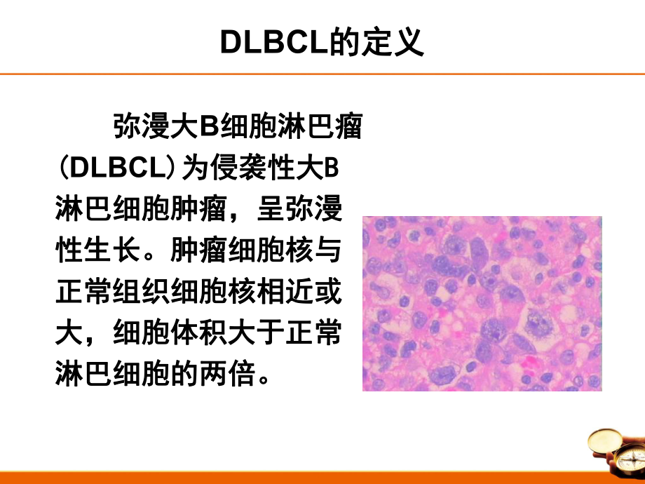 中国弥漫大B细胞淋巴瘤诊治指南2013ppt课件.ppt_第2页