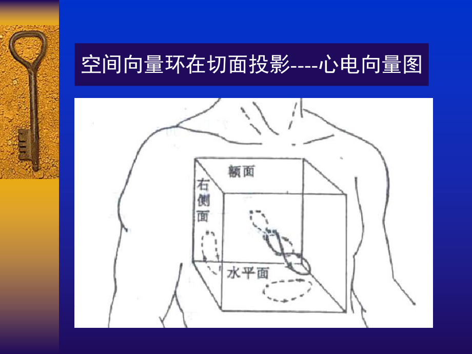 常见心电图诊断要点ppt课件.ppt_第2页