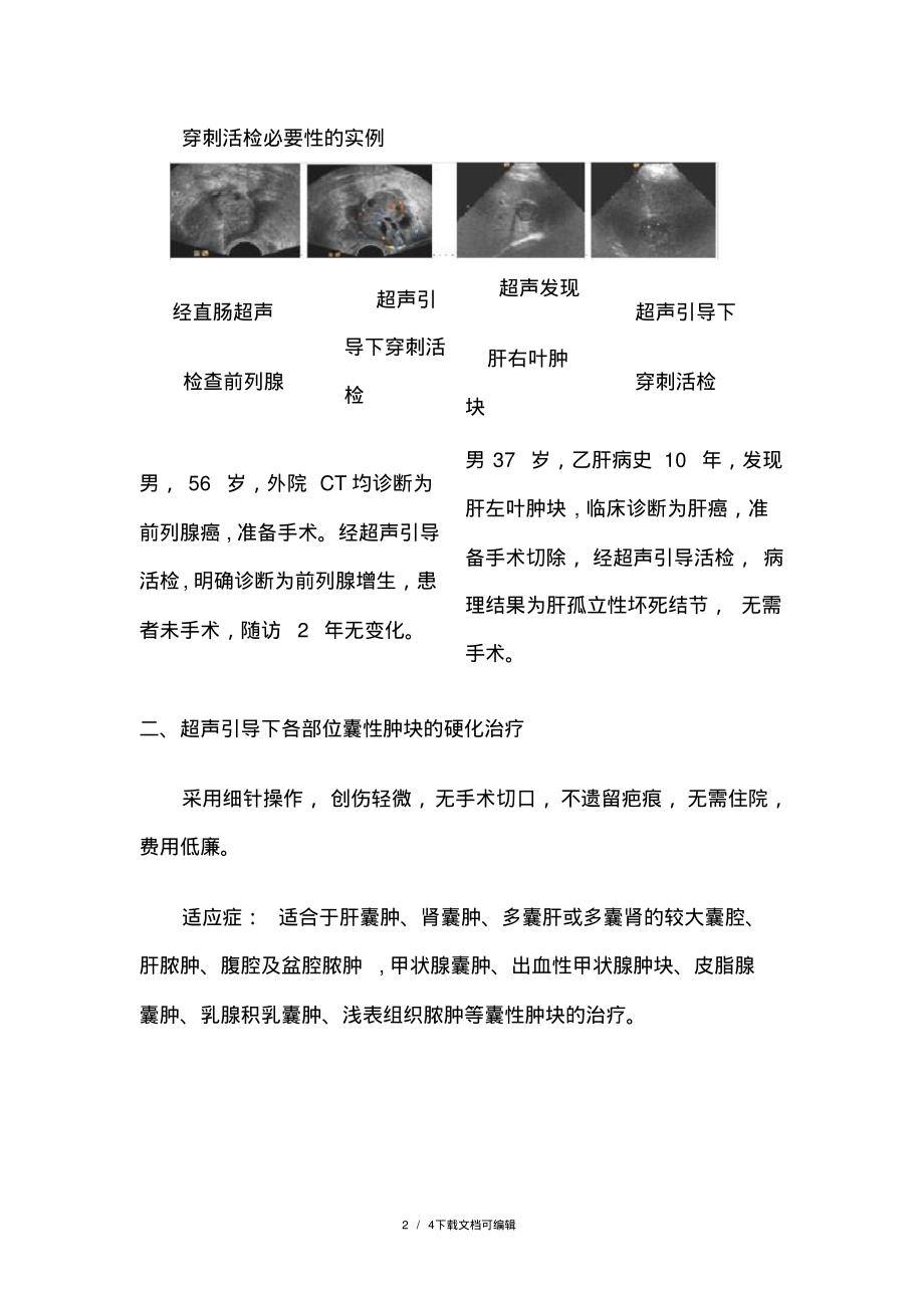 超声引导下的穿刺活检和介入治疗.pdf_第2页