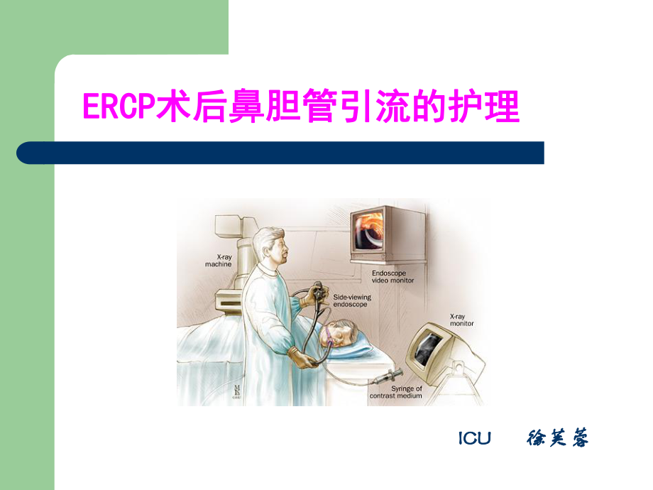 ERCP及相关技术护理ppt课件.ppt_第2页