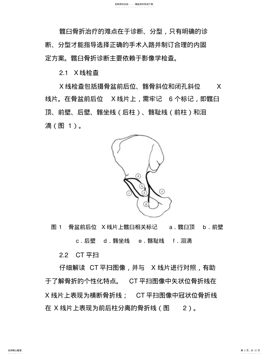 2022年2022年髋臼骨折 .pdf_第2页