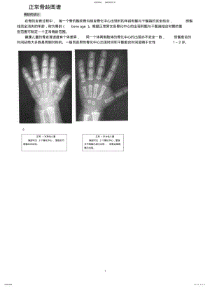 2022年2022年骨龄之对照标准 .pdf