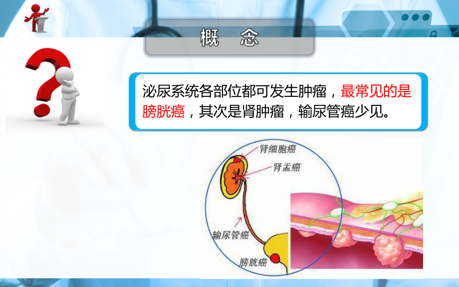 《外科护理》第十九章-第五节-泌尿系统肿瘤病人的护理ppt课件.ppt_第2页