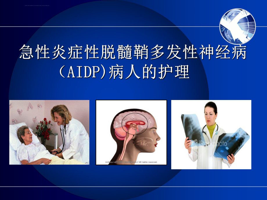 急性炎症性脱髓鞘多发性神经病(AIDP)病人的护理ppt课件.ppt_第1页