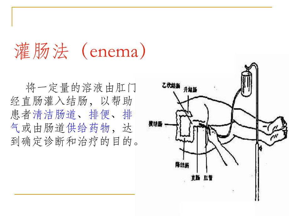 保留灌肠法ppt课件.pptx_第2页