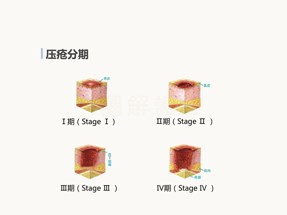 压疮疼痛评估ppt课件.pptx_第2页