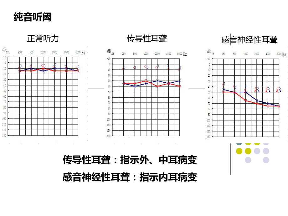 常见耳源性眩晕的诊断与治疗ppt课件.ppt_第2页