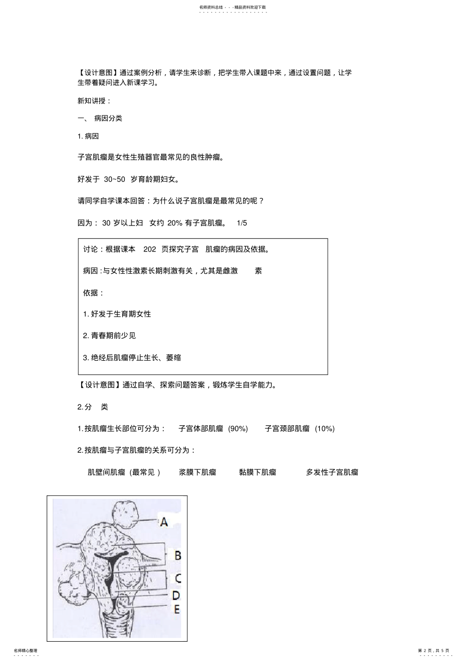 2022年子宫肌瘤教案 .pdf_第2页