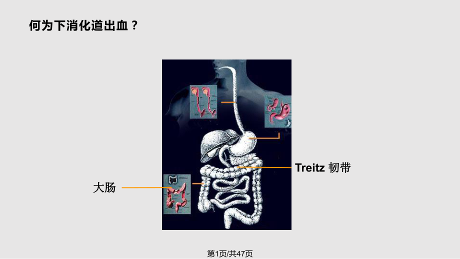 下消化道出血的诊治16519.pptx_第1页