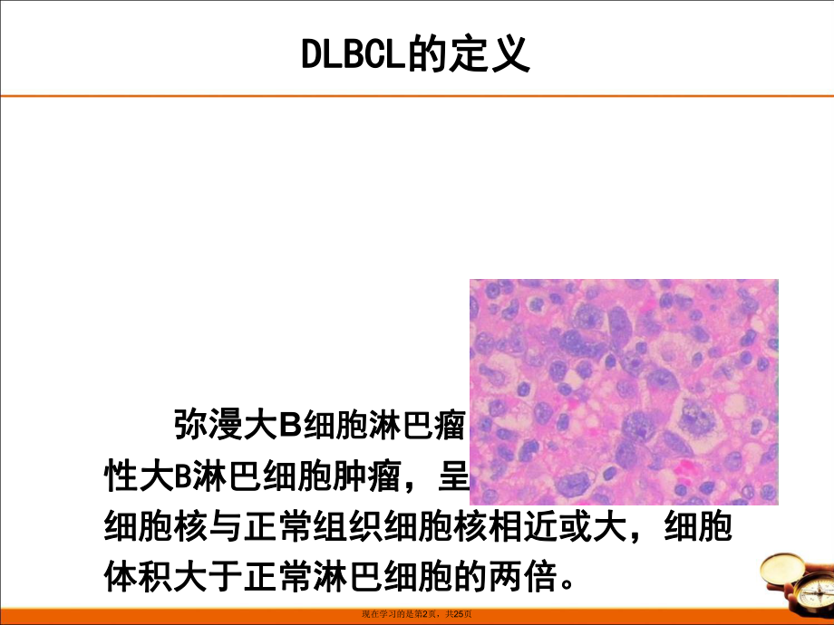 中国弥漫大细胞淋巴瘤诊治指南.ppt_第2页