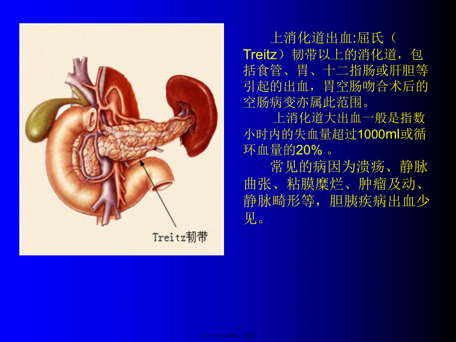 上消化道出血诊断与治疗.ppt_第2页